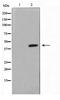 LAG1 longevity assurance homolog 4 antibody, TA347627, Origene, Western Blot image 