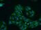 Neurotrophic Receptor Tyrosine Kinase 2 antibody, 13129-1-AP, Proteintech Group, Immunofluorescence image 