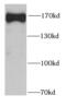 Scaffold Attachment Factor B2 antibody, FNab07579, FineTest, Western Blot image 