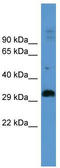Adenosine A2b Receptor antibody, TA342791, Origene, Western Blot image 
