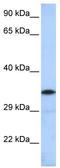 Potassium Channel Tetramerization Domain Containing 4 antibody, TA338793, Origene, Western Blot image 