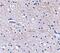 F-Box And Leucine Rich Repeat Protein 20 antibody, PA5-20485, Invitrogen Antibodies, Immunohistochemistry paraffin image 