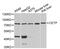Cholesteryl Ester Transfer Protein antibody, MBS127149, MyBioSource, Western Blot image 