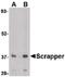 F-Box And Leucine Rich Repeat Protein 20 antibody, PA5-20486, Invitrogen Antibodies, Western Blot image 