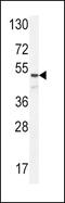 Angiopoietin 1 antibody, PA5-23954, Invitrogen Antibodies, Western Blot image 