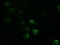 GATA Binding Protein 4 antibody, LS-C784106, Lifespan Biosciences, Immunofluorescence image 
