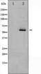 PKB beta antibody, TA325222, Origene, Western Blot image 