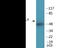 RUNX Family Transcription Factor 1 antibody, EKC2017, Boster Biological Technology, Western Blot image 