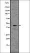 Protein Wnt-5a antibody, orb336652, Biorbyt, Western Blot image 