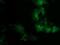 PDZ And LIM Domain 2 antibody, MA5-25515, Invitrogen Antibodies, Immunocytochemistry image 