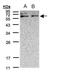 Xylulokinase antibody, PA5-21932, Invitrogen Antibodies, Western Blot image 