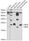 Ubiquitin Conjugating Enzyme E2 F (Putative) antibody, GTX64701, GeneTex, Western Blot image 