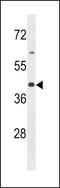 Olfactory Receptor Family 2 Subfamily B Member 6 antibody, LS-C158014, Lifespan Biosciences, Western Blot image 
