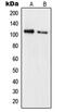 RB Transcriptional Corepressor 1 antibody, MBS822147, MyBioSource, Western Blot image 