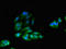 Insulin receptor substrate 2 antibody, LS-C682206, Lifespan Biosciences, Immunofluorescence image 