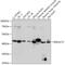 Beta-1,4-Galactosyltransferase 2 antibody, 16-989, ProSci, Western Blot image 