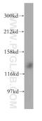 SH3 domain-binding protein 4 antibody, 17691-1-AP, Proteintech Group, Western Blot image 
