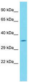 Family With Sequence Similarity 49 Member A antibody, TA331709, Origene, Western Blot image 