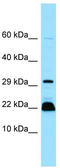Myosin regulatory light chain 2, skeletal muscle isoform antibody, TA331214, Origene, Western Blot image 