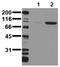 Insulin Receptor antibody, AM00075PU-N, Origene, Western Blot image 