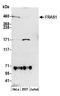 Fraser Extracellular Matrix Complex Subunit 1 antibody, A305-622A-M, Bethyl Labs, Western Blot image 