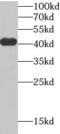Tropomodulin 4 antibody, FNab08802, FineTest, Western Blot image 
