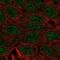 Envoplakin Like antibody, NBP1-94178, Novus Biologicals, Immunofluorescence image 