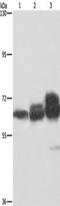 Lamin A/C antibody, TA349382, Origene, Western Blot image 