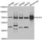 5'-Aminolevulinate Synthase 1 antibody, LS-C334773, Lifespan Biosciences, Western Blot image 