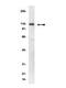Actinin Alpha 1 antibody, GTX18061, GeneTex, Western Blot image 