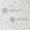 Reticulocalbin 2 antibody, A7721, ABclonal Technology, Immunohistochemistry paraffin image 
