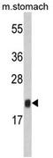 FKBP Prolyl Isomerase 11 antibody, AP17378PU-N, Origene, Western Blot image 