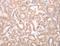 Monoacylglycerol lipase ABHD12 antibody, LS-C401147, Lifespan Biosciences, Immunohistochemistry frozen image 