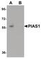 Gbp antibody, PA5-20951, Invitrogen Antibodies, Western Blot image 