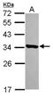Haloacid Dehalogenase Like Hydrolase Domain Containing 3 antibody, NBP2-16798, Novus Biologicals, Western Blot image 