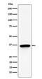Translocase Of Inner Mitochondrial Membrane 50 antibody, M10056-1, Boster Biological Technology, Western Blot image 