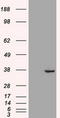 Caudal Type Homeobox 2 antibody, CF500251, Origene, Western Blot image 