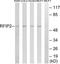 RAB11 Family Interacting Protein 2 antibody, TA315185, Origene, Western Blot image 
