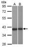 Leucine Rich Repeat Containing 23 antibody, LS-C155682, Lifespan Biosciences, Western Blot image 