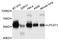 Lysophosphatidylcholine Acyltransferase 1 antibody, A4987, ABclonal Technology, Western Blot image 