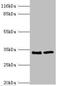 EBP Cholestenol Delta-Isomerase antibody, orb351145, Biorbyt, Western Blot image 