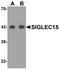 Sialic acid-binding Ig-like lectin 15 antibody, PA5-72765, Invitrogen Antibodies, Western Blot image 