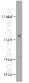 Interleukin-2 receptor subunit beta antibody, 13602-1-AP, Proteintech Group, Western Blot image 