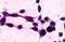 Xenotropic And Polytropic Retrovirus Receptor 1 antibody, GTX71325, GeneTex, Immunocytochemistry image 
