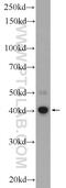 Fatty Acid Hydroxylase Domain Containing 2 antibody, 22046-1-AP, Proteintech Group, Western Blot image 