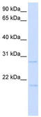 POD1 antibody, TA343371, Origene, Western Blot image 