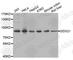 DExD-Box Helicase 21 antibody, A4277, ABclonal Technology, Western Blot image 