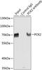 Phosphoenolpyruvate Carboxykinase 2, Mitochondrial antibody, 23-590, ProSci, Immunoprecipitation image 