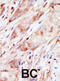 Glucokinase antibody, abx033753, Abbexa, Immunohistochemistry paraffin image 