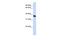 Ring Finger Protein 115 antibody, PA5-42304, Invitrogen Antibodies, Western Blot image 